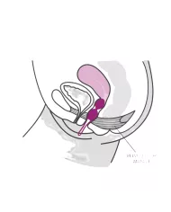 FUN FACTORY - SMARTBALLS DUO BOULES PELVIENNES BLANC / PISTACHE FUN FACTORY - SMARTBALLS DUO BOULES PELVIENNES BLANC / PISTACHE