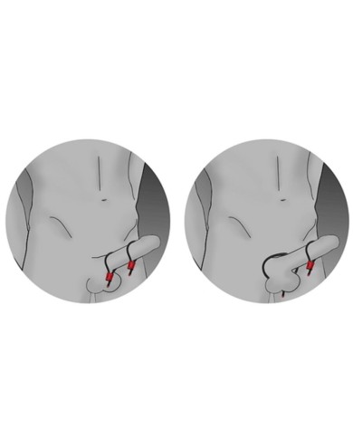 ELECTRASTIM - PRESTIGE ELECTRA LOOPS ANNEAUX PÉNIENS RÉGLABLES ROUGES